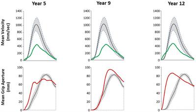 Case Report: True Motor Recovery of Upper Limb Beyond 5 Years Post-stroke